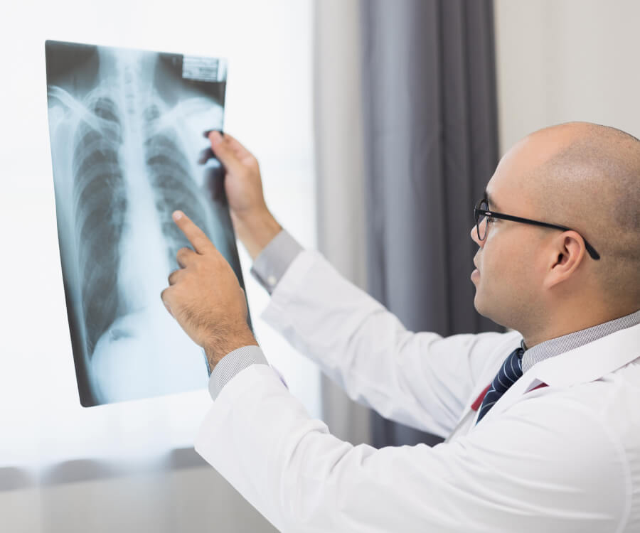 doctor looking at xray of the chest