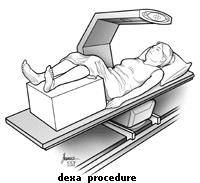 Illustration of a person laying in a dexa scan machine