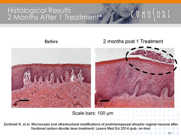 diagram: histological results - before and 2 months after treatment